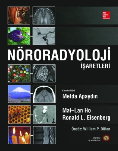 Kurye Kitabevi - Nöroradyoloji İşaretleri Ciltli