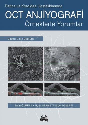 Kurye Kitabevi - Retina ve Koroidea Hastalıklarında OCT Anjiyografi-Ör